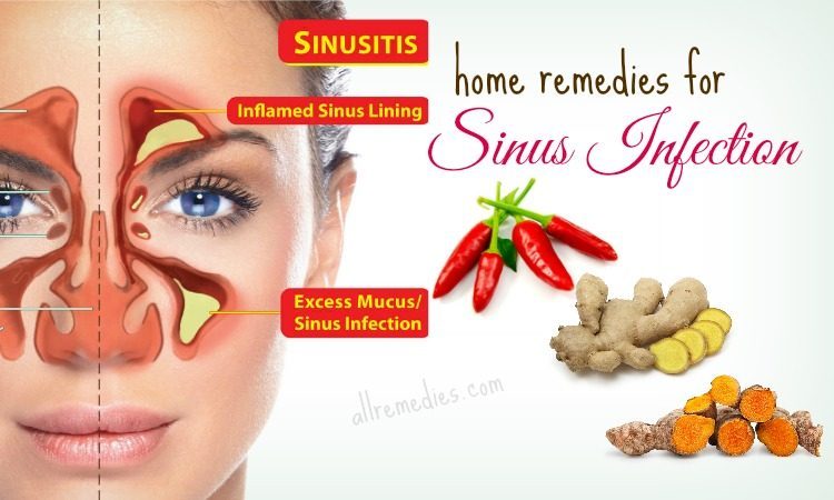 What are some home remedies for sinus infection?