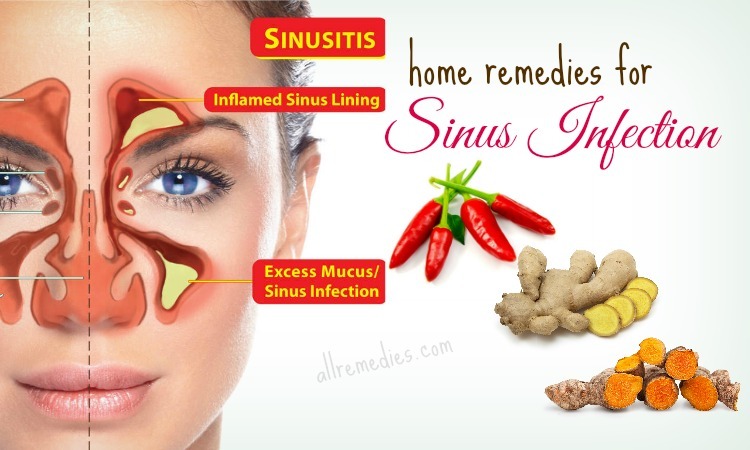 Best Home Remedies For Sinus Infection