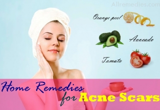 34 best natural home remedies for acne scars on face and body