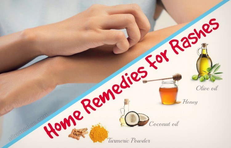 Top 24 Natural Home Remedies For Rashes On Body