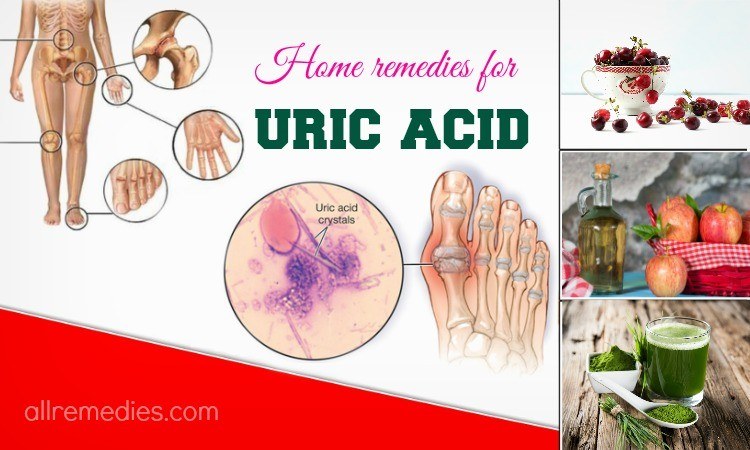 12 Natural Home Remedies for Uric Acid Problems