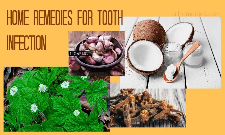 26 Natural Home Remedies for Tooth Infection Pain