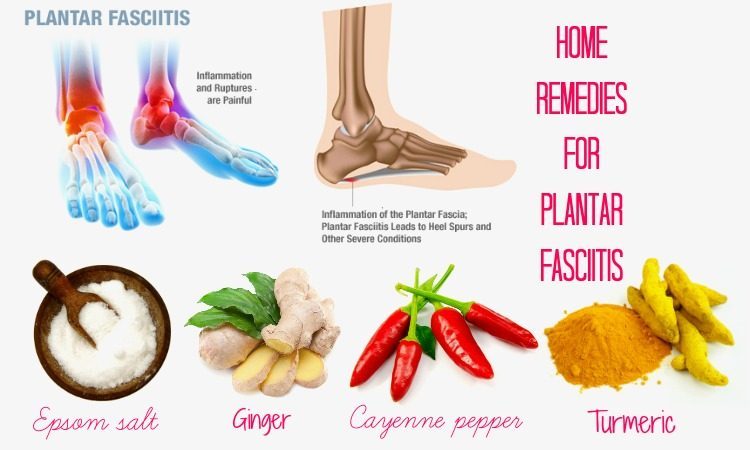 home remedies for planters fasciitis