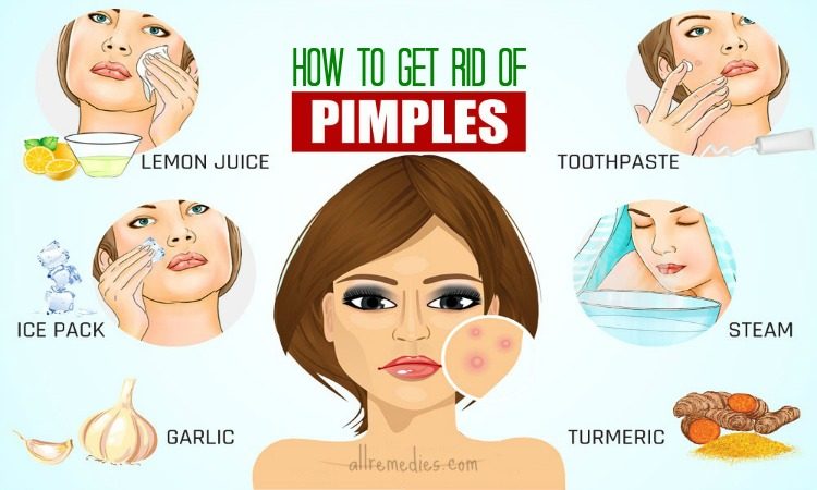 20 Tips How to Get Rid of Pimples Fast and Naturally