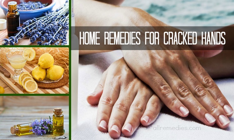 home remedies for cracked hands
