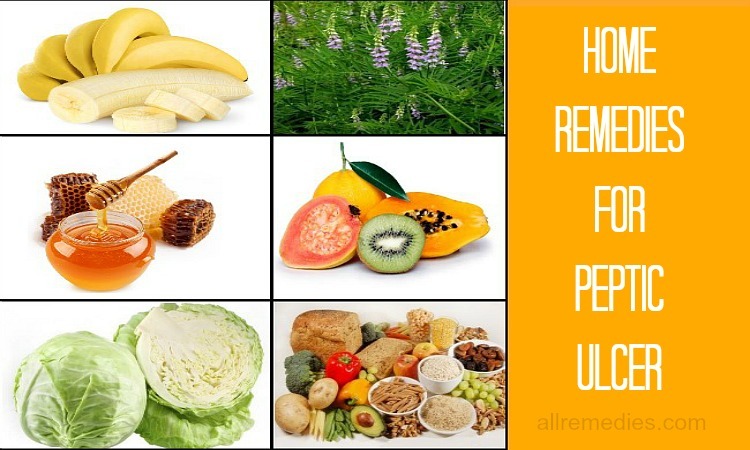 home remedies for peptic ulcer