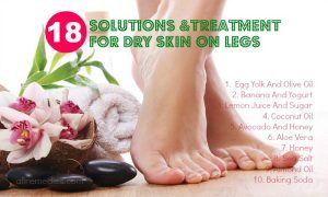 Treatment for Dry Skin  around Legs: 18 Solutions