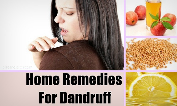 home remedies for dandruff