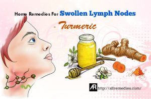 42 Home Remedies for Swollen Lymph Nodes: Causes, Symptoms, Tips