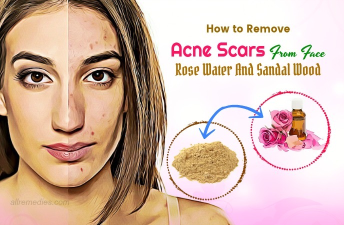 how to remove acne scars from face
