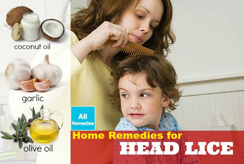 home remedies for head lice