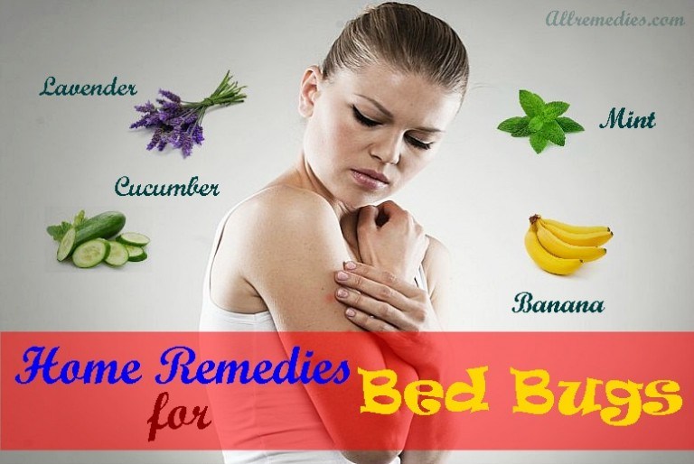 bed bug bite remedies