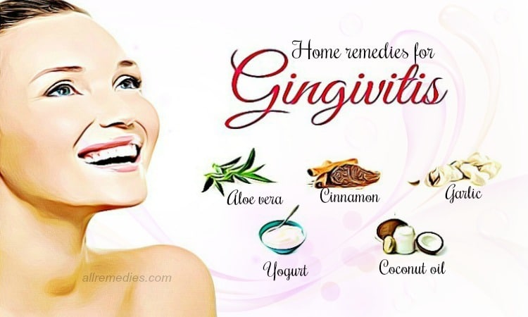 home remedies for gingivitis