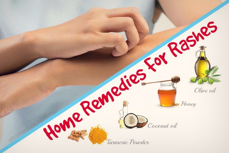 home remedies for rashes