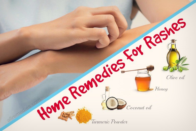 Skin Rash Home Remedies