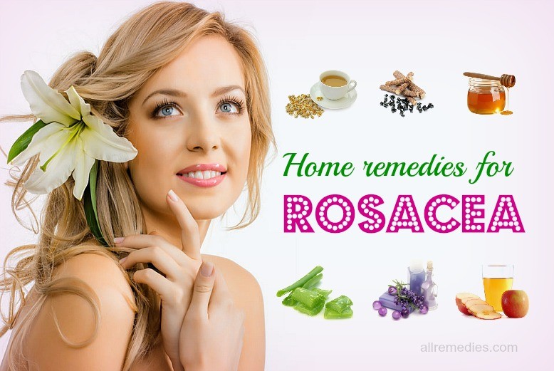 home remedies for rosacea