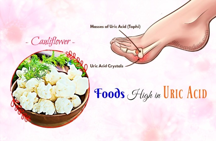 foods high in uric acid