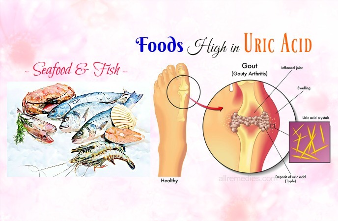 foods high in uric acid