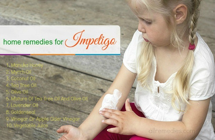 home remedies for impetigo