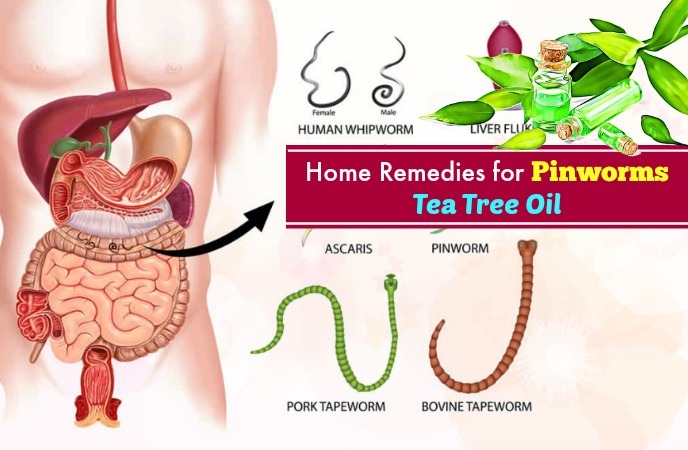 home remedies for pinworms