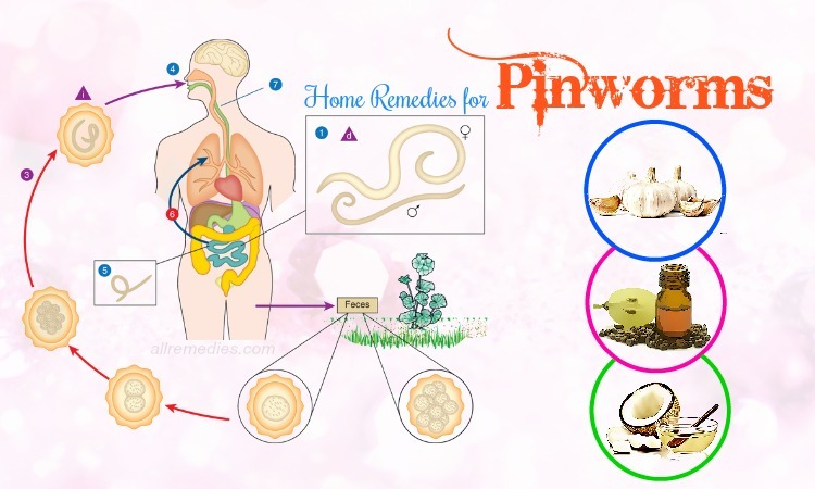 home remedies for pinworms.