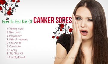 37 Tips On How To Get Rid Of Canker Sores Fast And Naturally