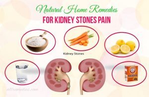 43 Natural Home Remedies for Kidney Stones Pain