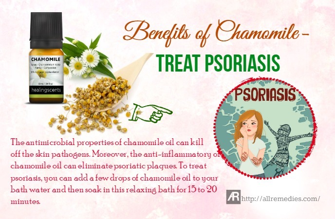 benefits of chamomile