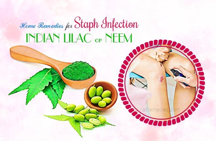home remedies for staph infection
