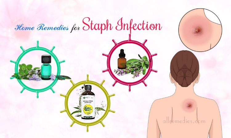 home remedies for staph infection