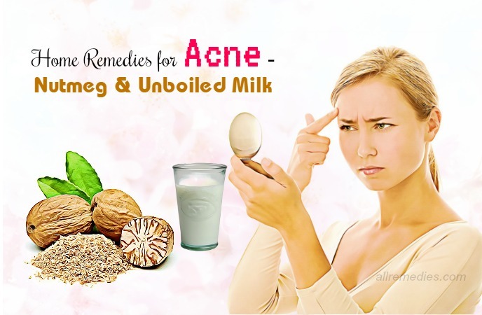 home remedies for acne