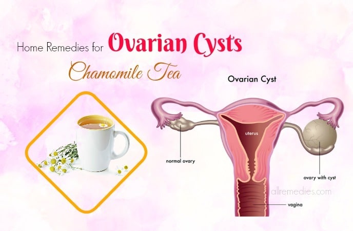 home remedies for ovarian cysts
