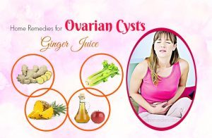 Image showcasing Top 19 Effective And Natural Home Remedies For Ovarian Cysts Pain