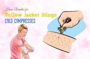 stings swelling compresses