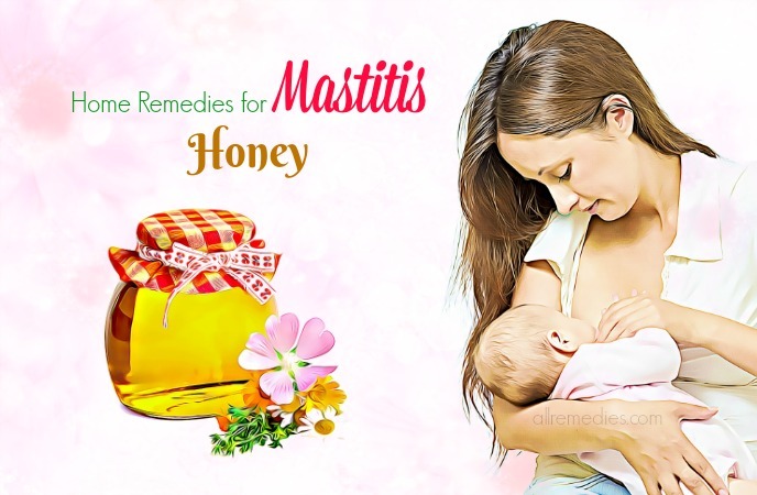 home remedies for mastitis