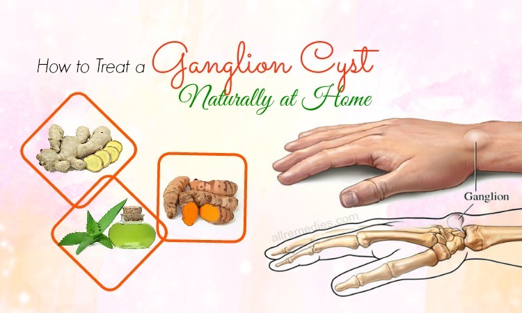how to treat a ganglion cyst