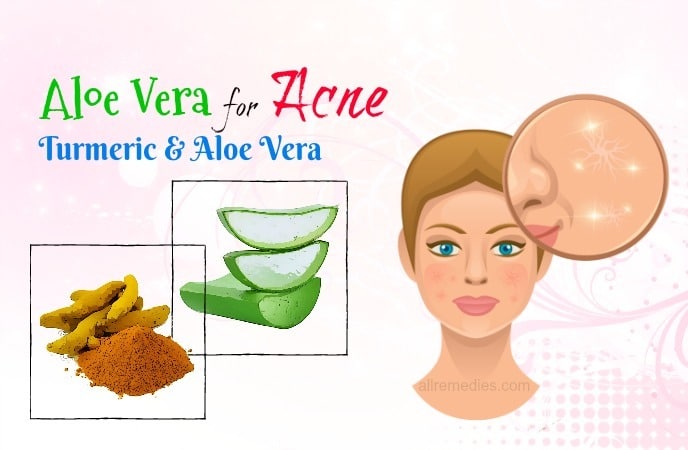 aloe vera for acne