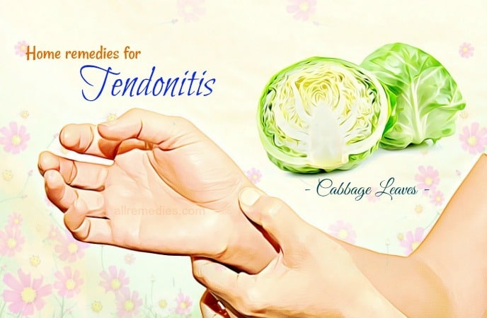 home remedies for tendonitis