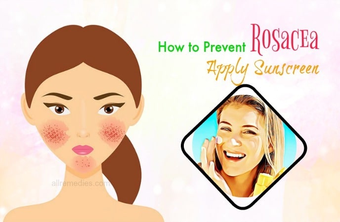 how to prevent rosacea