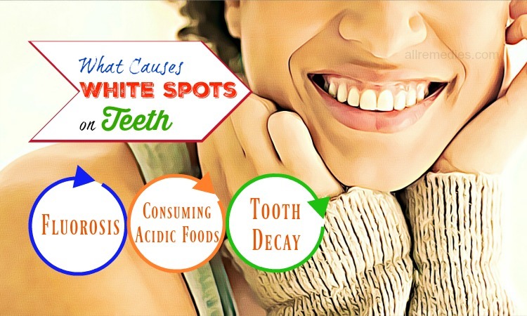 what causes white spots on teeth