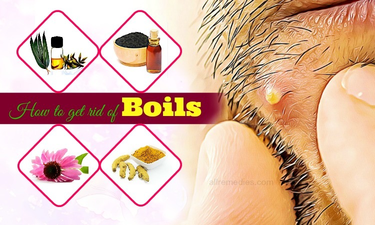 how to get rid of boils