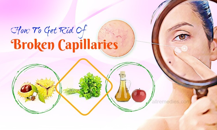 how to get rid of broken capillaries