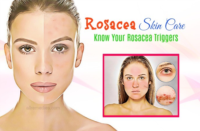rosacea skin care