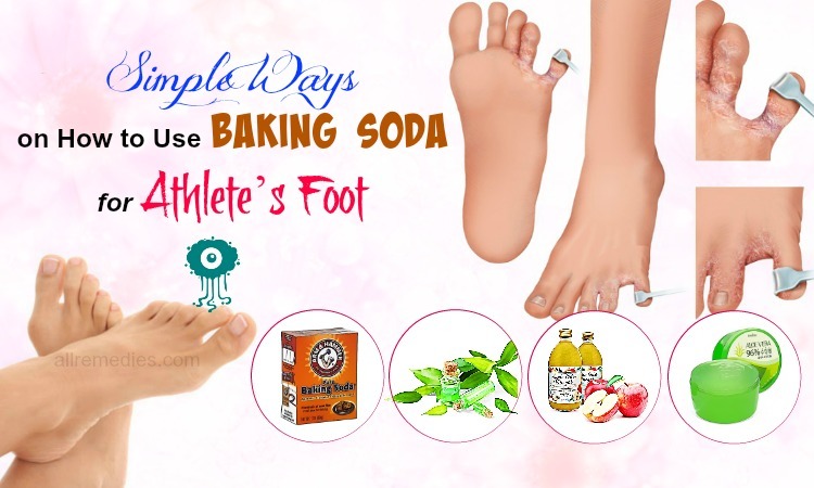 baking soda for athletes foot