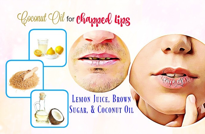 top-8-natural-ways-on-how-to-use-coconut-oil-for-chapped-lips