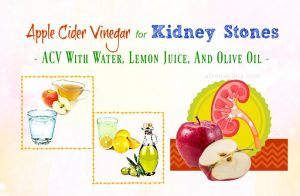 Apple cider vinegar bladder stones Clearance
