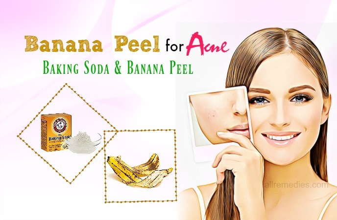 banana peel for acne