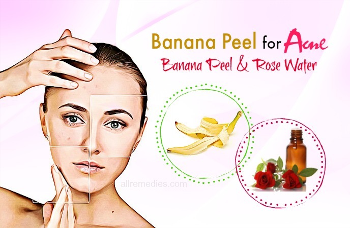 banana peel for acne