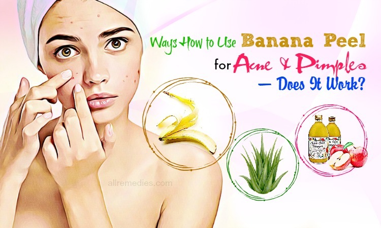 banana peel for acne