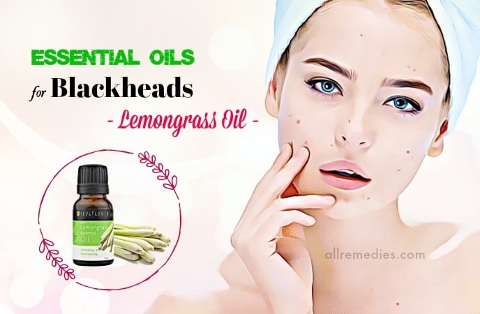 essential oils for blackheads